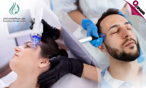 RF Microneedling for Face, Neck, & Underarm Sweat Control!